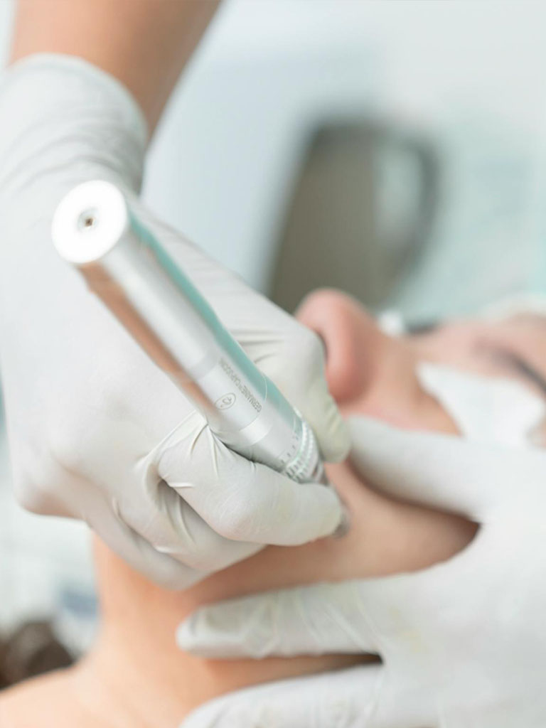 Plasma Skin Care Image