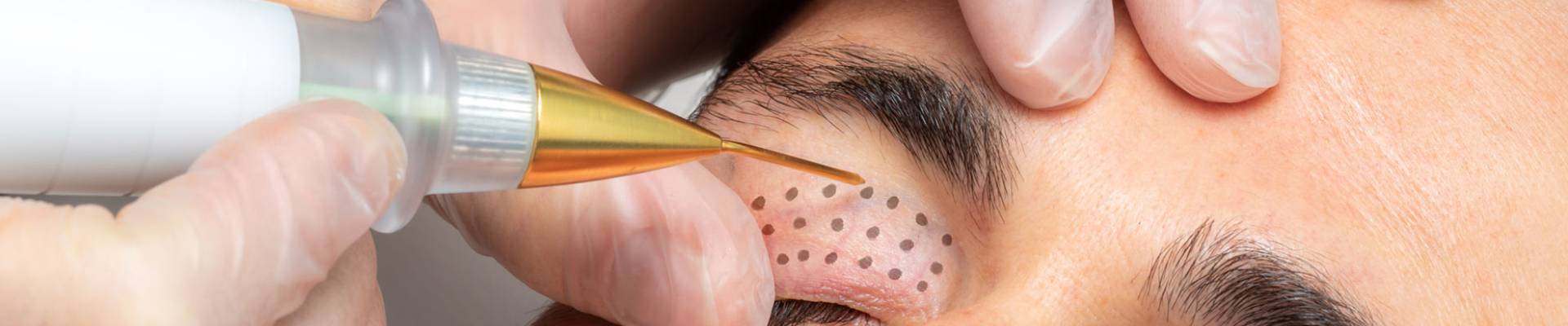 Aqua Facial Header